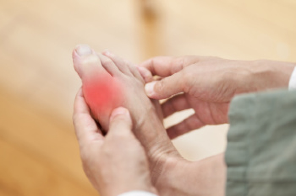 Gout and the Health Conditions That Often Accompany It