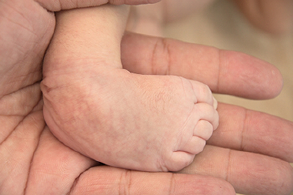 Common Pediatric Foot Alignment Conditions